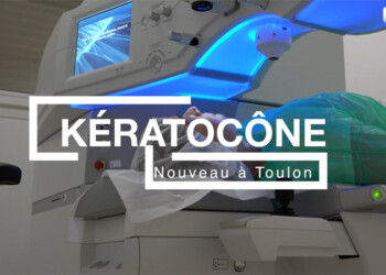 Kératocône Toulon