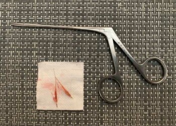 Les épillets sont dangereux pour nos animaux